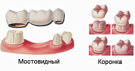 Каронки и Мости 